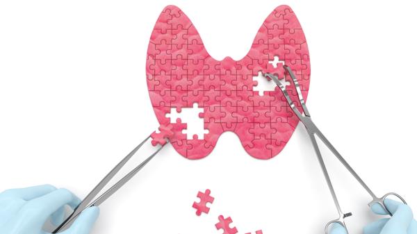 Bacimed SALUD: Efecto mariposa, cómo saber cuándo falla la glándula tiroides