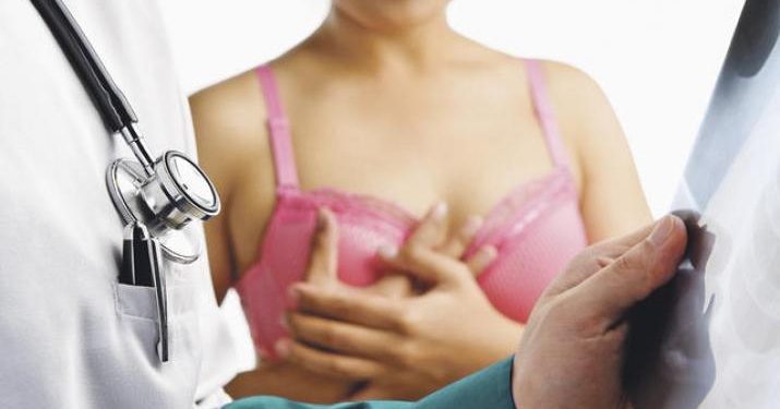 Bacimed Se reaviva la polémica alrededor de los implantes mamarios: ¿provocan 